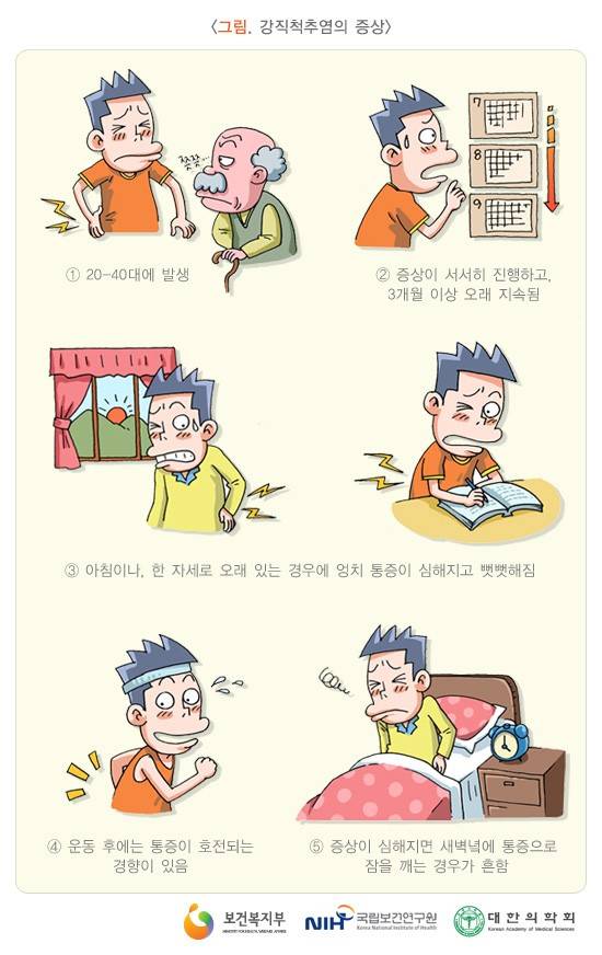 제주류마티스내과 강직성척추염 증상 12