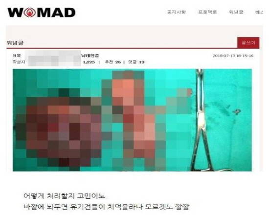 워마드 사이트에 올라온 낙태인증 사진. 끔찍한 사진을 올려놓고 패륜아적인 글을 첨부해 놨다. ⓒ 구글 캡쳐