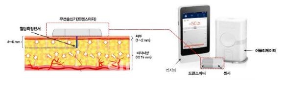 아이센스가 개발 중인 연속혈당측정기 개념도. ⓒ 아이센스