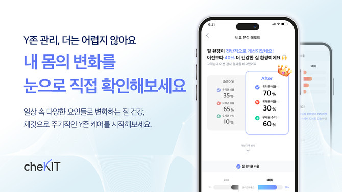 뷰니브랩, 여성 질 건강 검사 키트 '체킷' 추천 제품군 확대 - 뉴스 썸네일 이미지