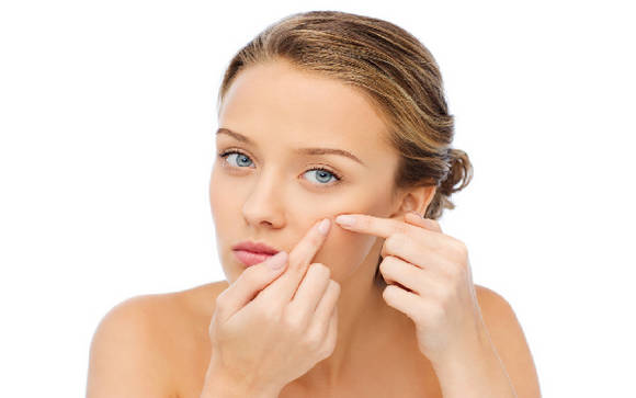 여드름이 났을 때에는 잘 낫게 해야해요. ⓒ 네이버 블로그