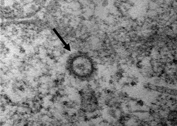 코로나19 바이러스(SARS-CoV-2)의 전자현미경 사진. ⓒ 질병관리본부