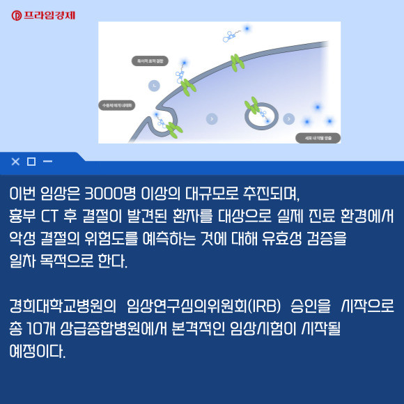카드] 압타머사이언스, 폐암 조기 진단키트 대규모 임상시험 착수