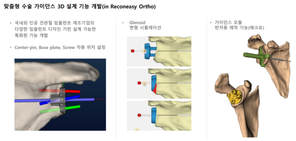 시안솔루션은 3D프린터를 이용해 개인 맞춤형 모델을 제작하고, 수술 전 가이드를 세부적으로 만들어주는 회사다. ⓒ 시안솔루션