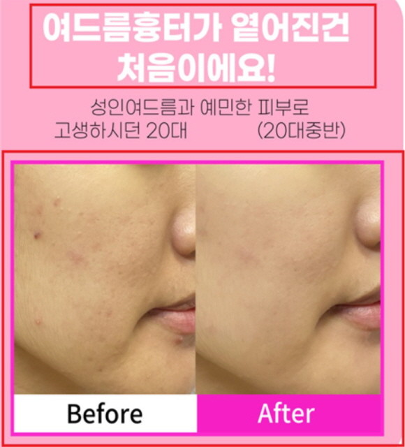 화장품을 의약품의 효능·효과가 있는 것처럼 광고. © 식약처